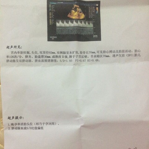 journal_insert_pic_631918695