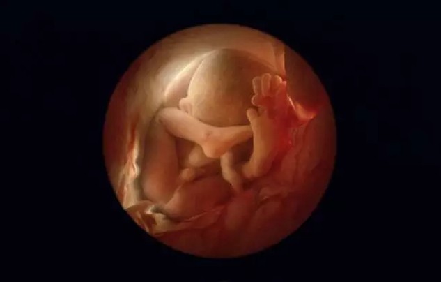 胎儿入盆照片图片