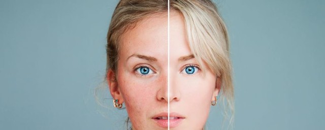 女性如何抗衰老